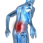 Epidurals-Relieve-Low-Back-Pain